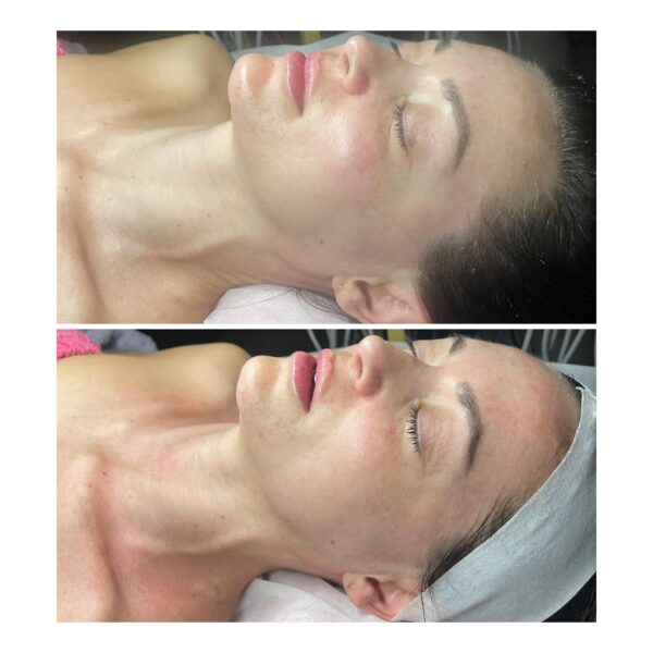 ULTIMATE CUSTOM BEAUTY UNFILTERED FACIAL