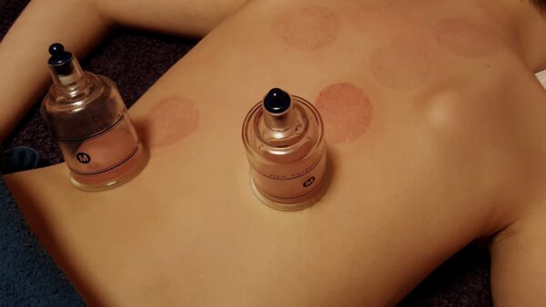 Cupping 30 Minute Session